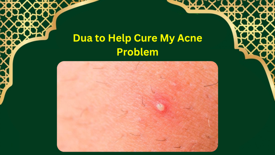 Dua to Help Cure My Acne Problem